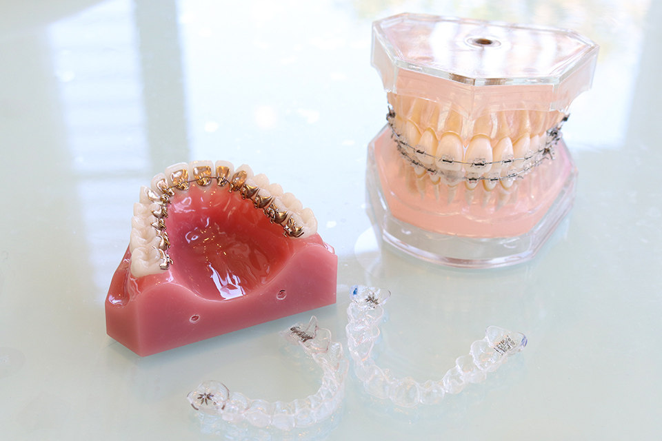 赤坂インプラント治療専門サイト｜赤坂B&S歯科・矯正歯科｜矯正装置