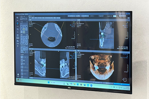 赤坂インプラント治療専門サイト｜赤坂B&S歯科・矯正歯科｜診断・治療計画