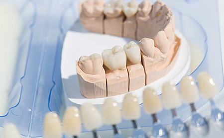 赤坂インプラント治療専門サイト｜赤坂B&S歯科・矯正歯科｜天然歯のような見た目