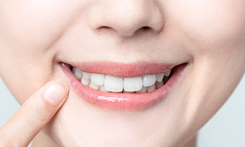 港区赤坂・赤坂見附の歯医者・矯正歯科「赤坂B&S歯科・矯正歯科」|出っ歯の治療