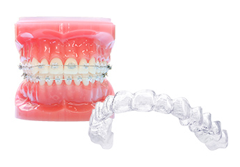 港区赤坂・赤坂見附で矯正歯科(マウスピース矯正)なら赤坂B&S歯科・矯正歯科｜治療開始