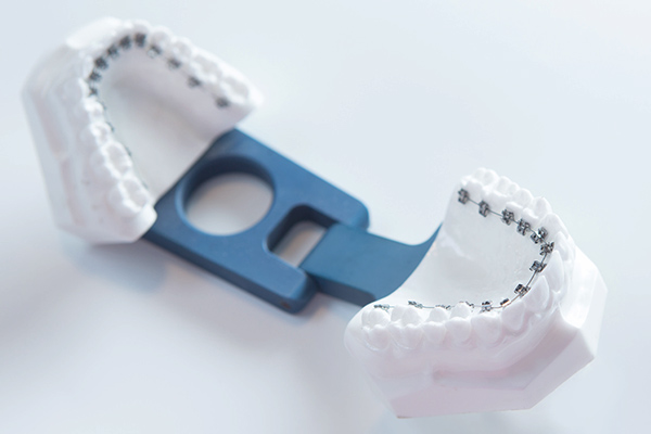 港区赤坂・赤坂見附の歯医者・矯正歯科「赤坂B&S歯科・矯正歯科」｜舌側矯正