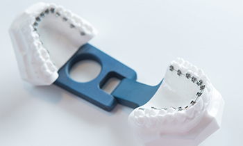 港区赤坂・赤坂見附の歯医者・矯正歯科「赤坂B&S歯科・矯正歯科」|リンガル矯正