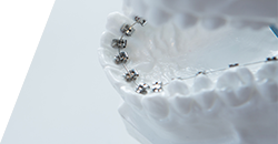 港区赤坂・赤坂見附の歯医者・矯正歯科「赤坂B&S歯科・矯正歯科」|リンガル矯正ページバナー