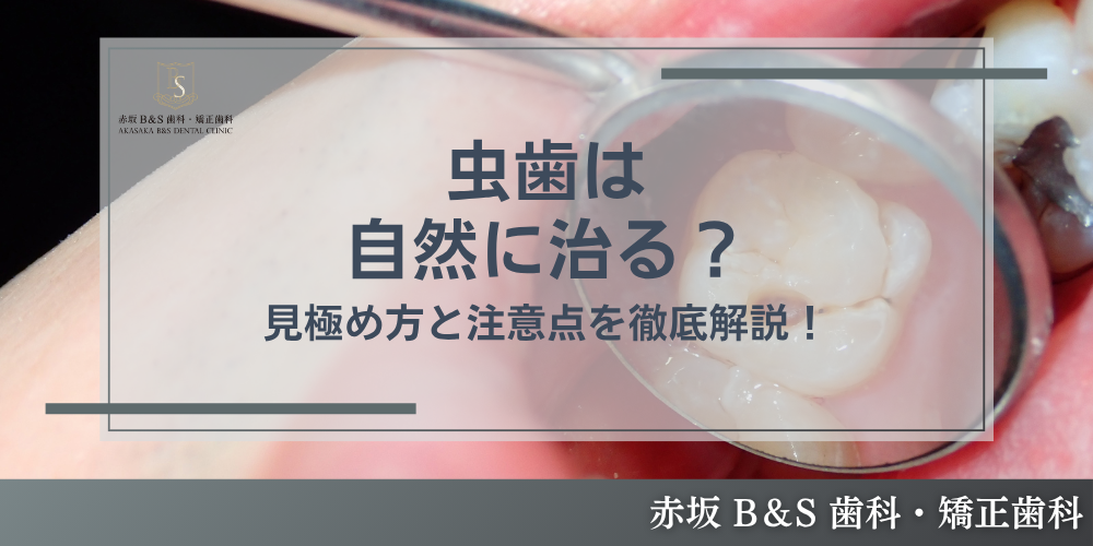 虫歯は自然に治る?見極め方と注意点を徹底解説!