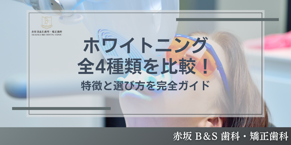 ホワイトニング全4種類を比較！特徴と選び方を完全ガイド