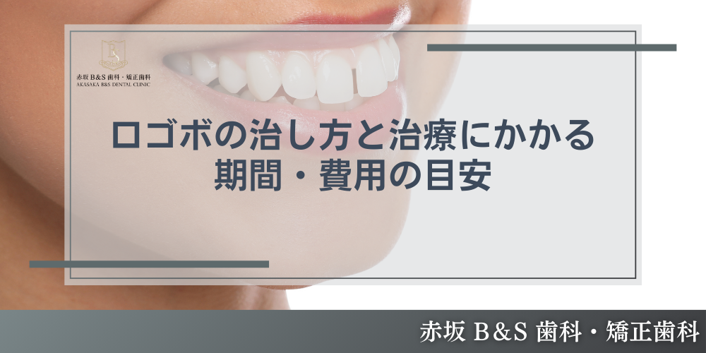 誰でもわかる！口ゴボの治し方と治療にかかる期間・費用の目安