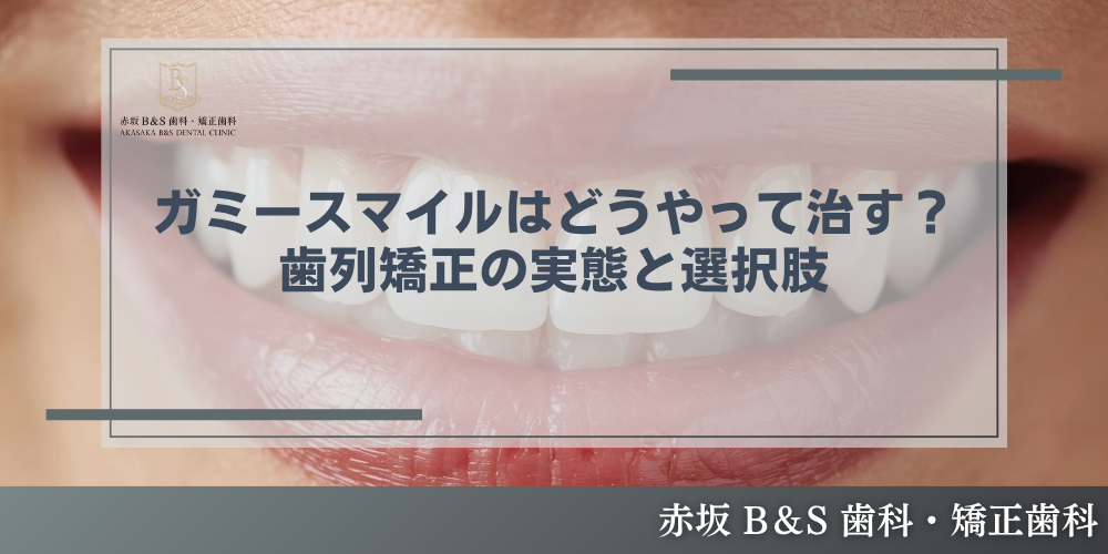 ガミースマイルはどうやって治す？ 歯列矯正の実態と選択肢
