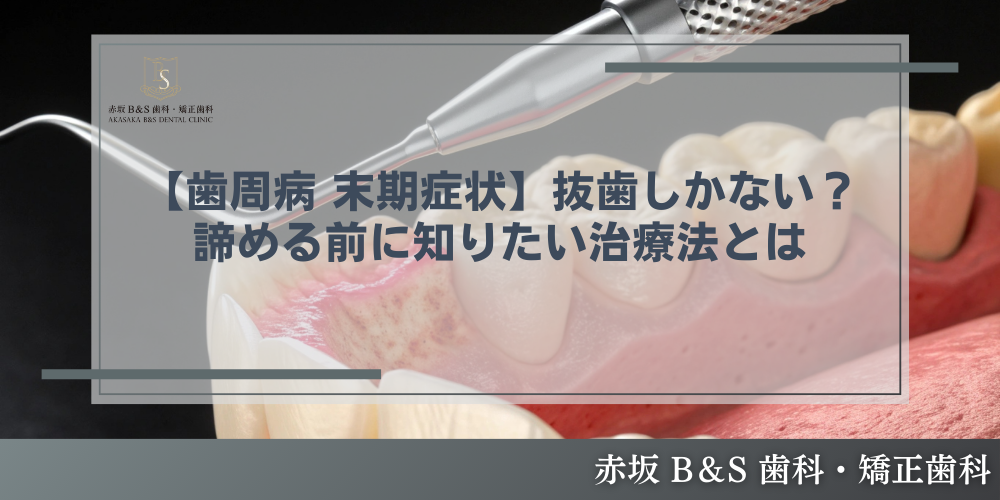 【歯周病 末期症状】抜歯しかない？諦める前に知りたい治療法とは