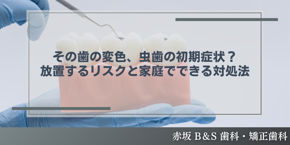その歯の変色、虫歯の初期症状？放置するリスクと家庭でできる対処法
