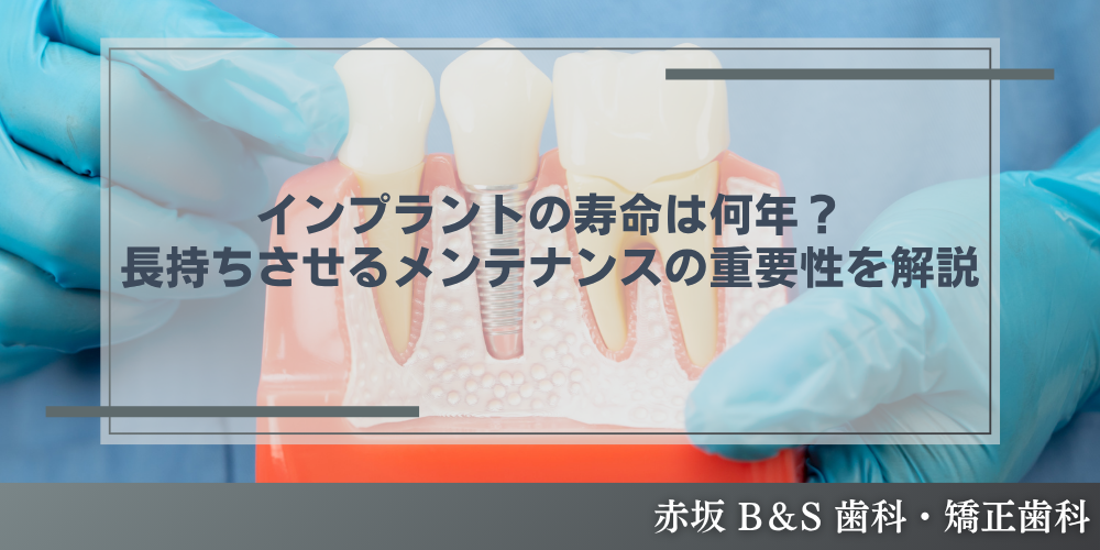 インプラントの寿命は何年？長持ちさせるメンテナンスの重要性を解説
