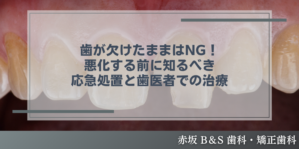 歯が欠けたままはNG！悪化する前に知るべき応急処置と歯医者での治療