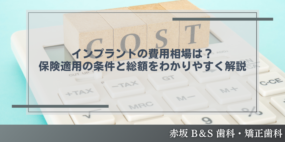 インプラントの費用相場は？保険適用の条件と総額をわかりやすく解説