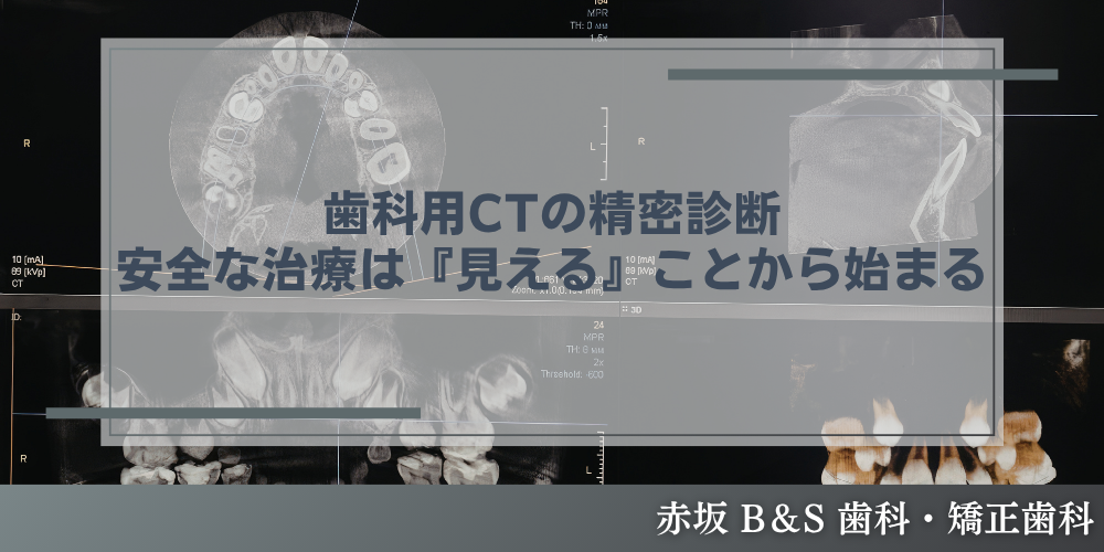 歯科用CTの精密診断｜安全な治療は『見える』ことから始まる