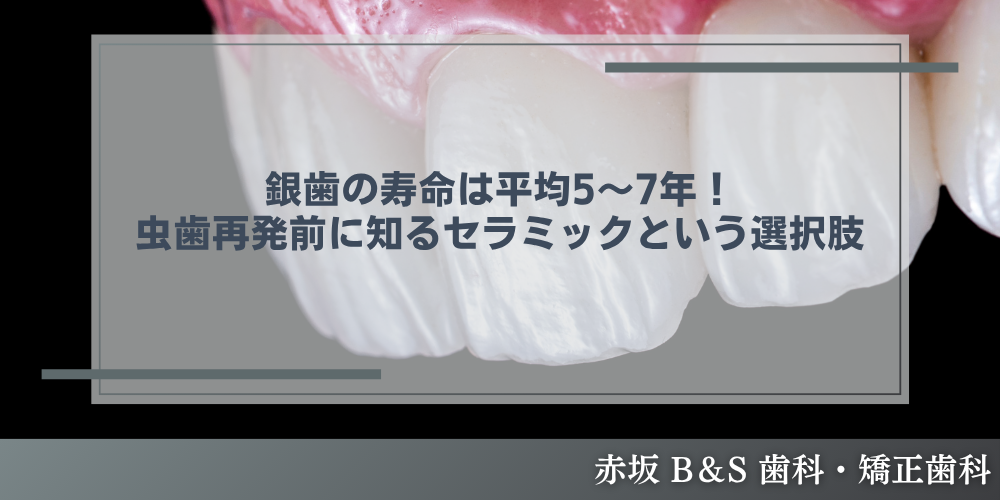 銀歯の寿命は平均5〜7年！虫歯再発前に知るセラミックという選択肢
