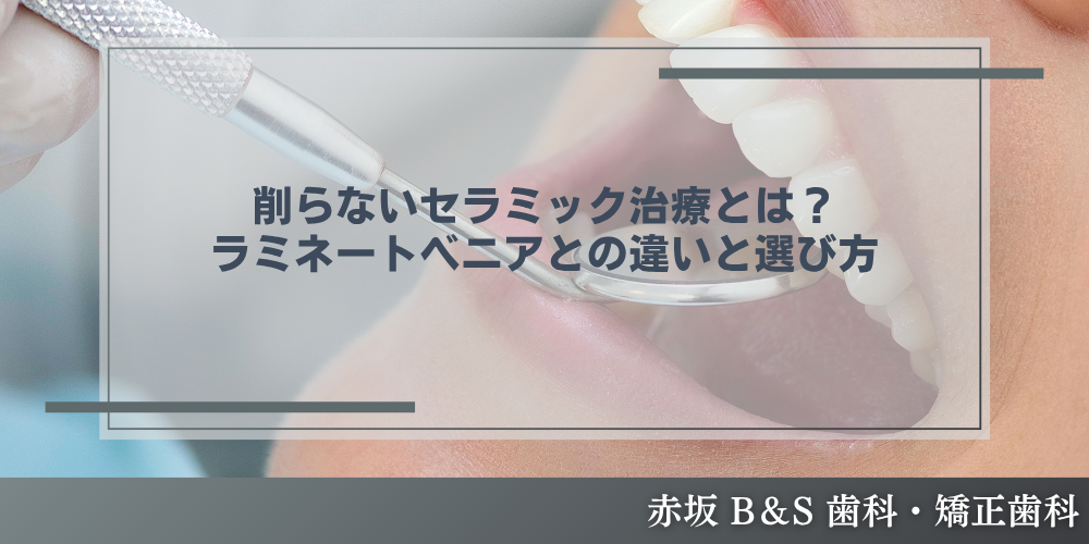 削らないセラミック治療とは？ラミネートベニアとの違いと選び方
