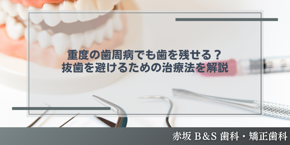 重度の歯周病でも歯を残せる？抜歯を避けるための治療法を解説